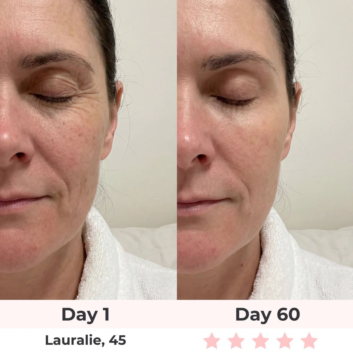 Lux Cove 7-In-1 LED Face Mask