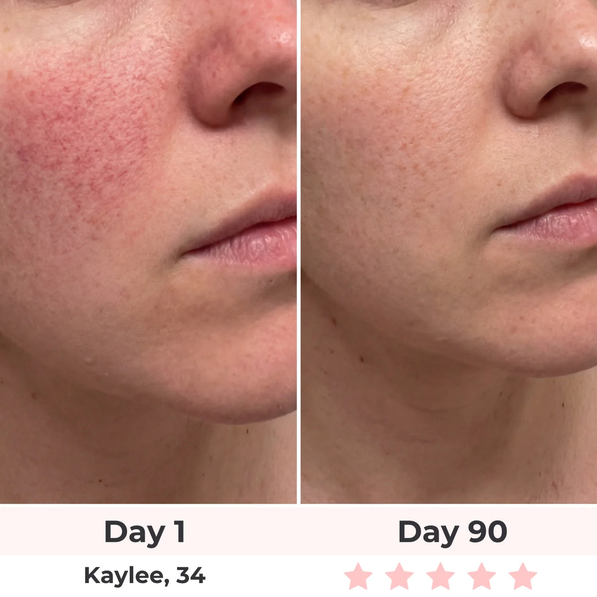 Lux Cove 7-In-1 LED Face Mask