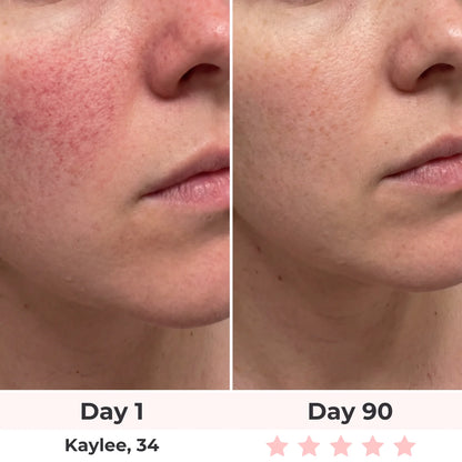 Lux Cove 7-In-1 LED Face Mask