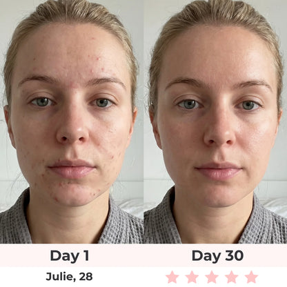 Lux Cove 7-In-1 LED Face Mask