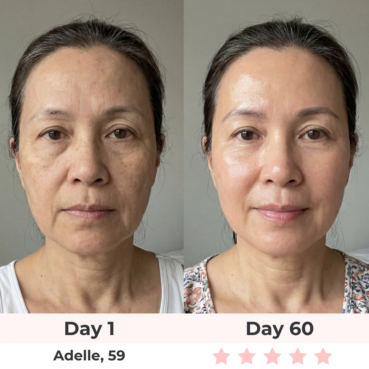 Lux Cove 7-In-1 LED Face Mask