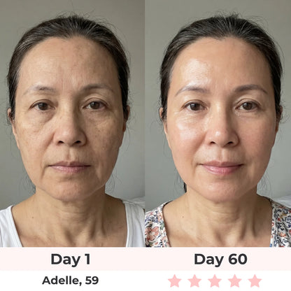 Lux Cove 7-In-1 LED Face Mask