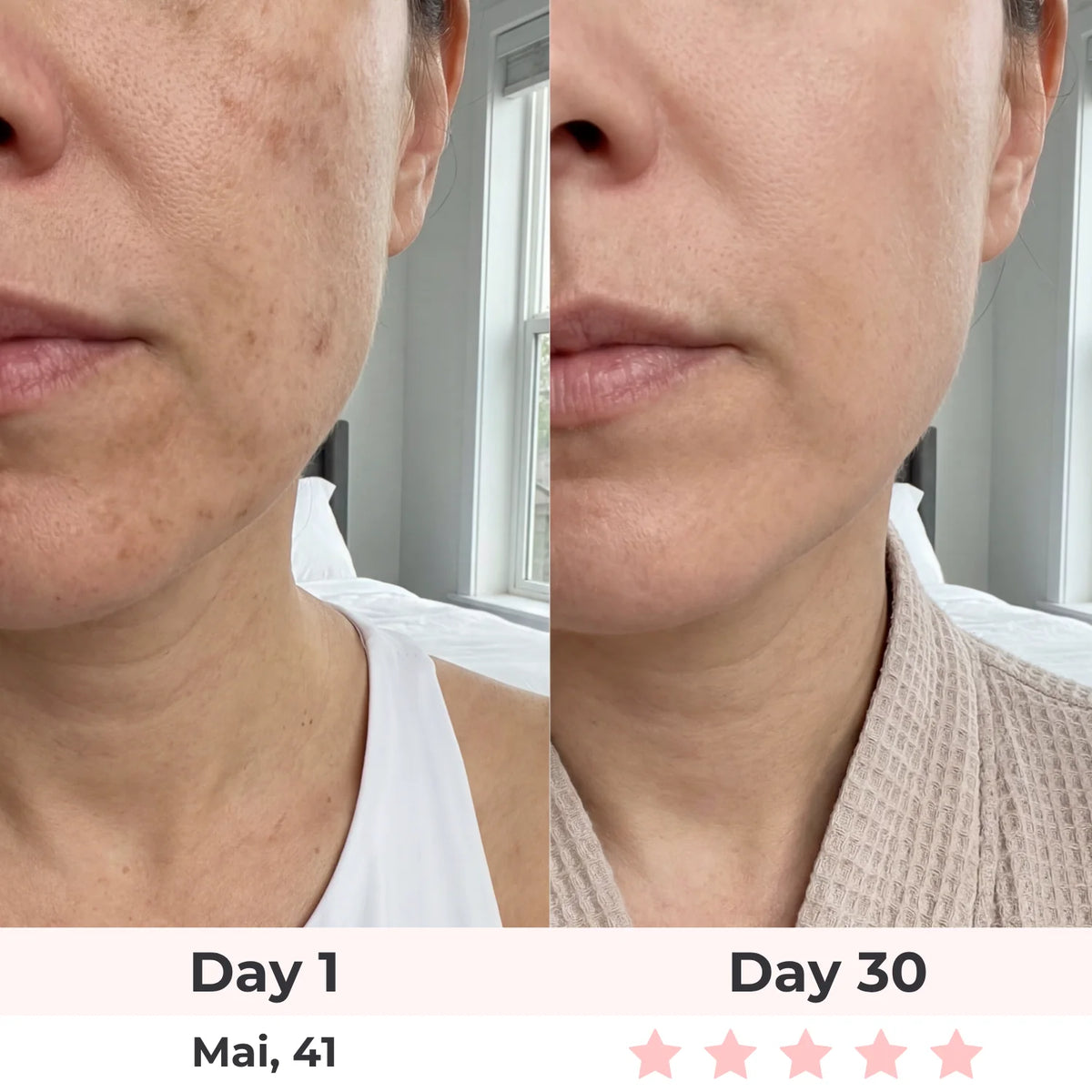 Lux Cove 7-In-1 LED Face Mask