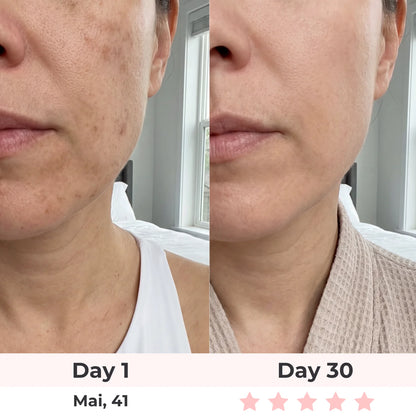Lux Cove 7-In-1 LED Face Mask